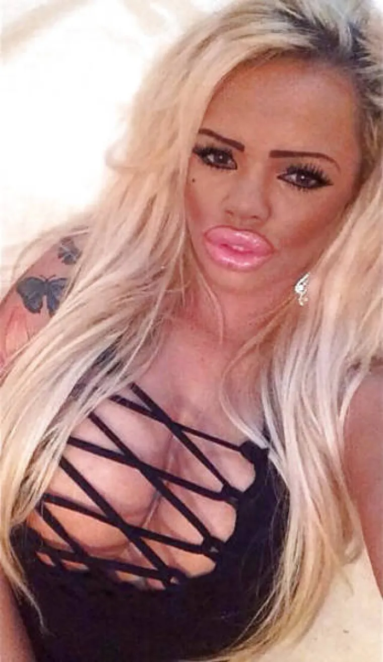 S MALO MA&Scaron;TE I PUNO PARA, SVATKO MOŽE POSTATI JEZIVA SPODOBA: Tek joj je 20, a već je silikonska veteranka