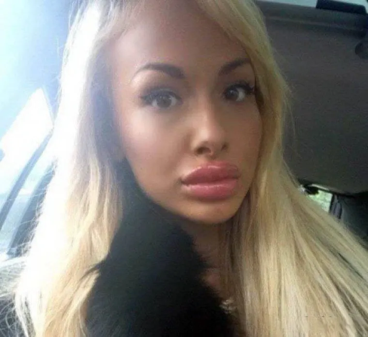 POTPUNO SE UNAKAZILE: Htjele ispasti ljepotice, a zavr&scaron;ile kao čiste spodobe