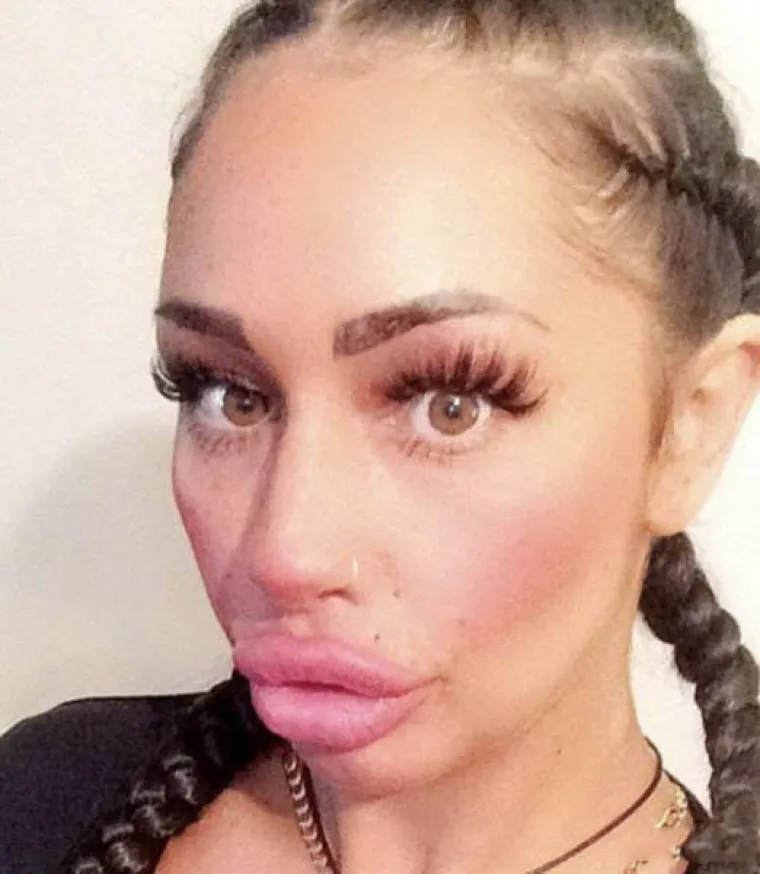 POTPUNO SE UNAKAZILE: Htjele ispasti ljepotice, a zavr&scaron;ile kao čiste spodobe