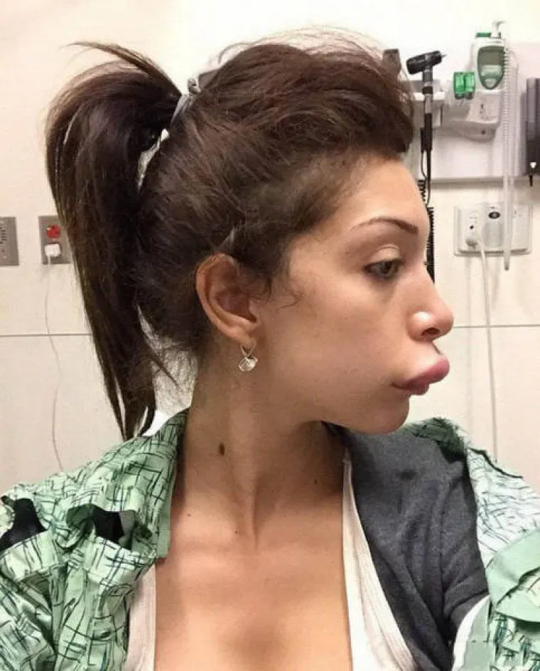 POTPUNO SE UNAKAZILE: Htjele ispasti ljepotice, a zavr&scaron;ile kao čiste spodobe