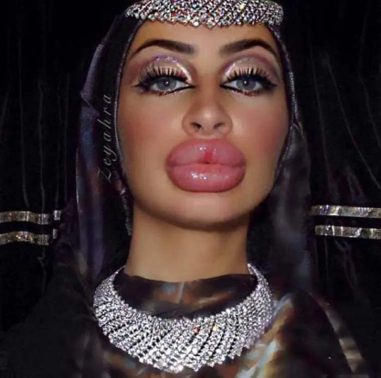 POTPUNO SE UNAKAZILE: Htjele ispasti ljepotice, a zavr&scaron;ile kao čiste spodobe