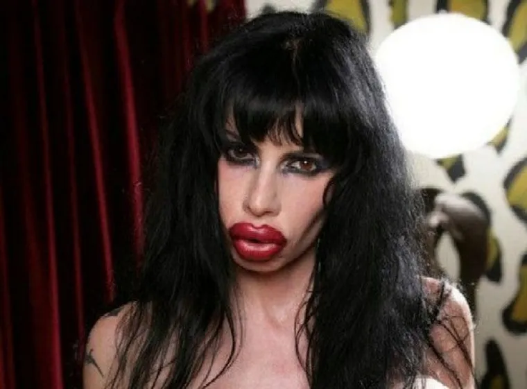 POTPUNO SE UNAKAZILE: Zbog ta&scaron;tine sjele pod nož i gorko požalile svoju odluku