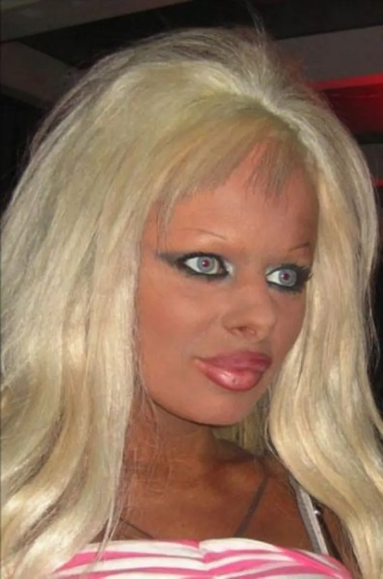 POTPUNO SE UNAKAZILE: Zbog ta&scaron;tine sjele pod nož i gorko požalile svoju odluku