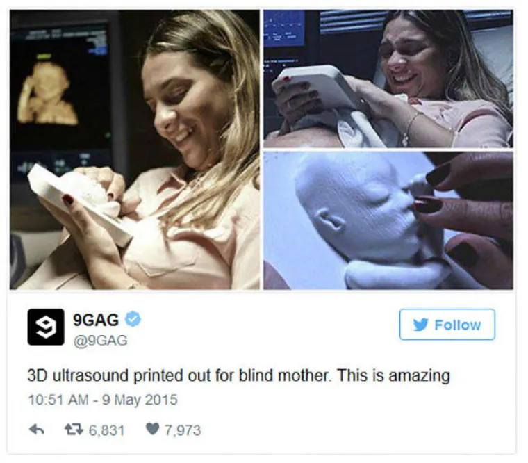 3D makete nerođenog djeteta nastale na temelju 3D ultrazvuka.