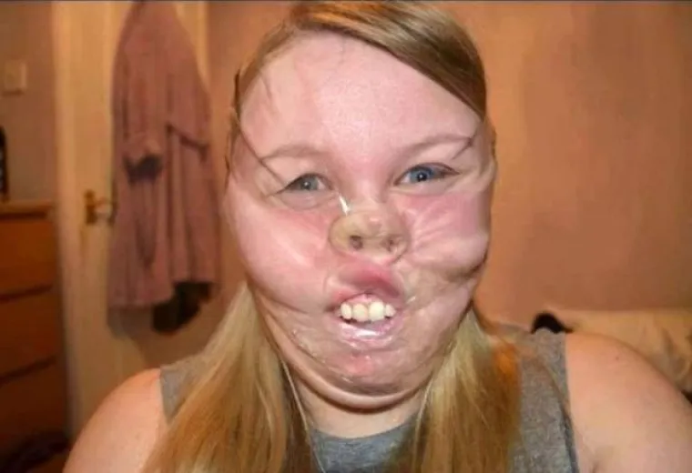 Selotejp selfie govori sam za sebe...
