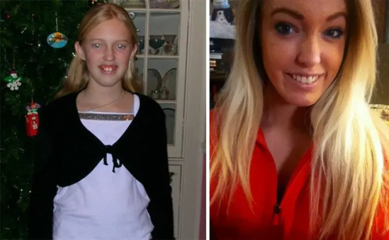 KAD RUŽNO PAČE POSTANE LABUD: U &scaron;koli su ih zafrkavali zbog izgleda, pogledajte ih danas