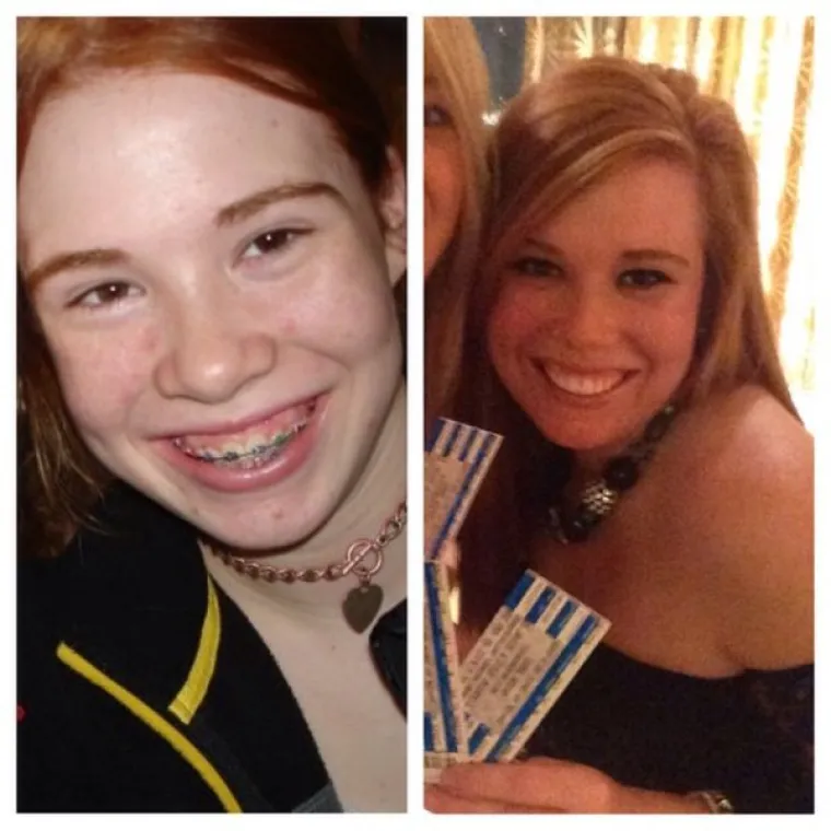 KAD RUŽNO PAČE POSTANE LABUD: U &scaron;koli su ih zafrkavali zbog izgleda, pogledajte ih danas