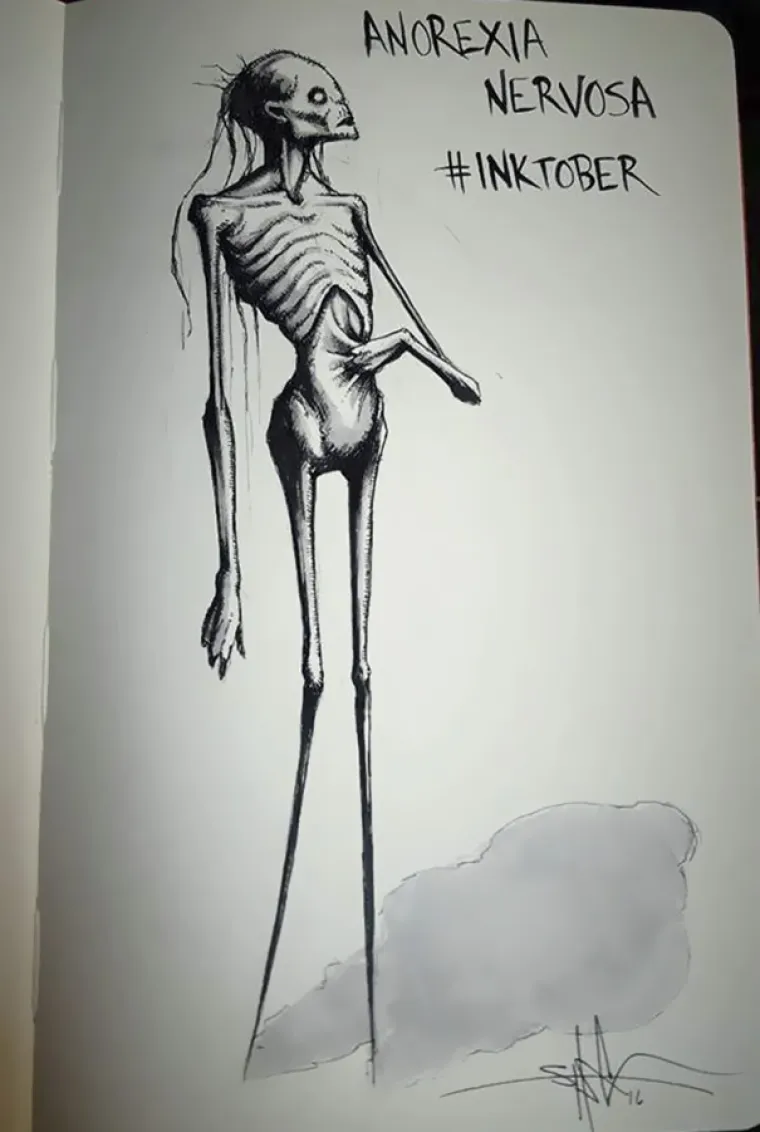 Anoreksija