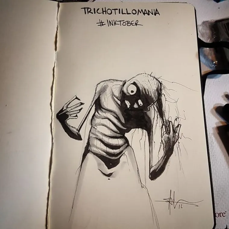 Trihotilomanija (kompulzivno čupanje kose)