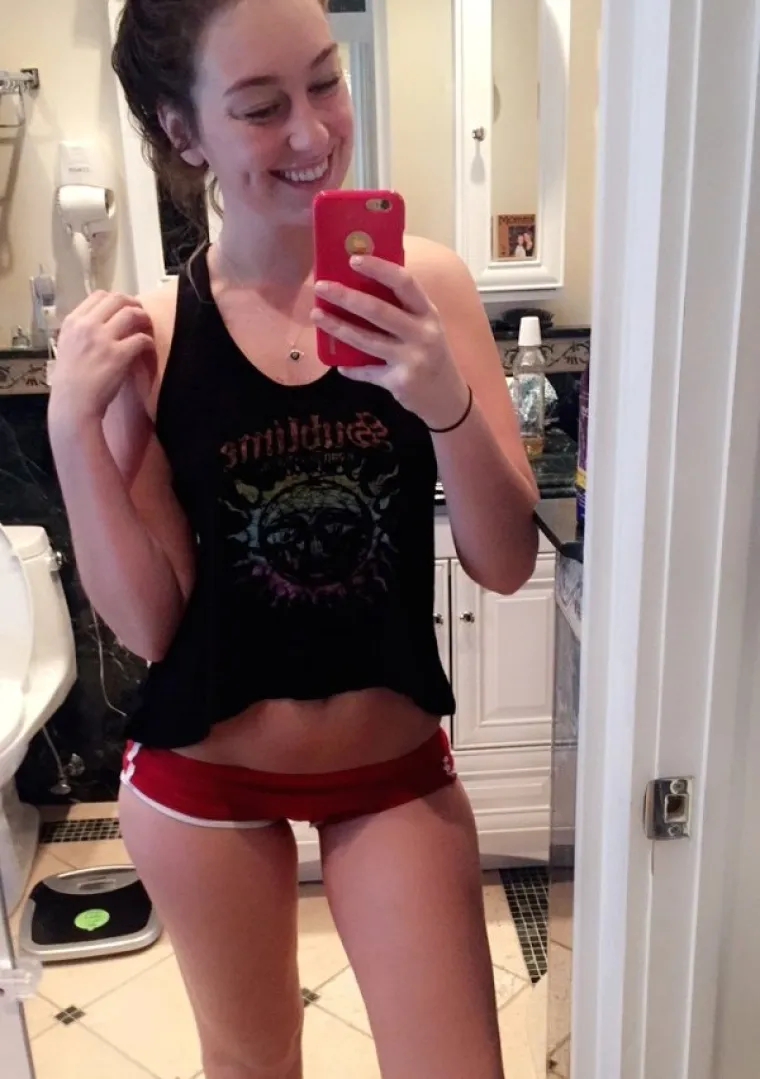 PRIZNAJTE, I VAMA BJEŽI OKO: Htjele su se pohvaliti slatkim jamicama na obrazu, ali svi gledaju ne&scaron;to drugo