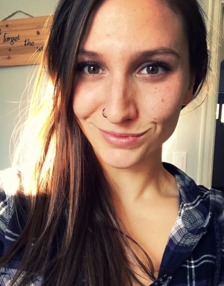 PRIZNAJTE, I VAMA BJEŽI OKO: Htjele su se pohvaliti slatkim jamicama na obrazu, ali svi gledaju ne&scaron;to drugo