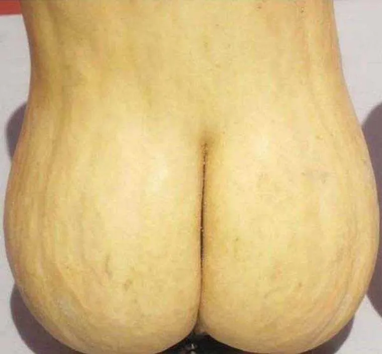 TESTIRAJTE SE: Vidite li i vi guzu u svemu ili imate neprirodno čisti um? Provjerite u galeriji!