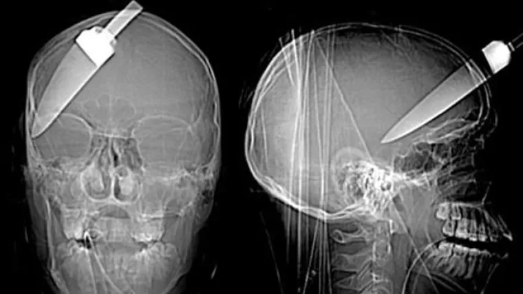 Ovo mu je nagrada &scaron;to je zaustavio pljačku.