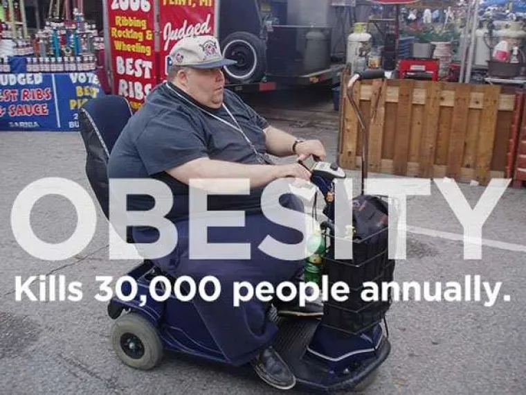 Pretilost ubije 30.000 ljudi godi&scaron;nje.