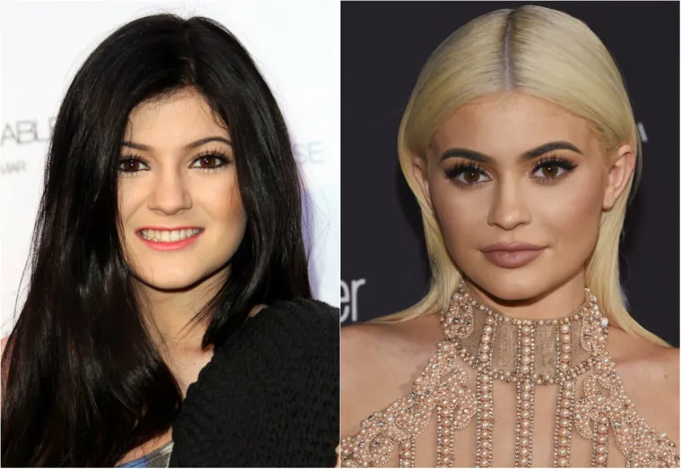Kylie Jenner
