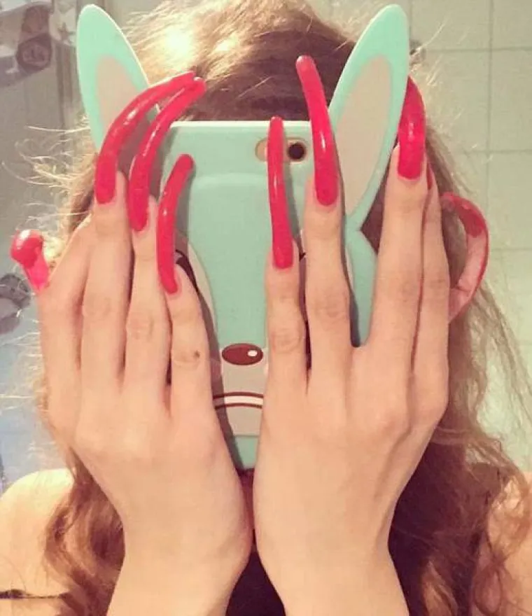 CURA PU&Scaron;TA NOKTE VEĆ 3 GODINE: Potpuno je nesposobna s njima, a ako slomi nokat uhvati je histerija