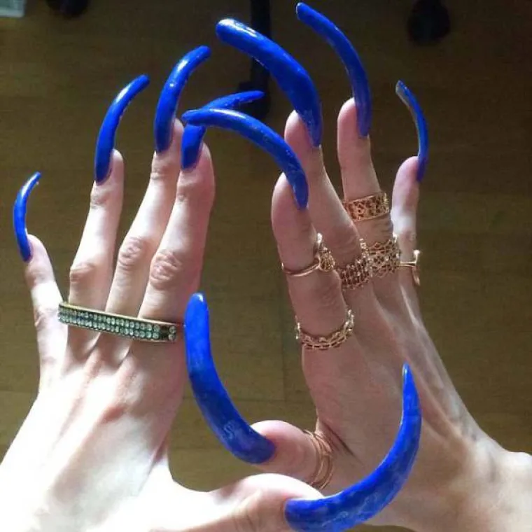 CURA PU&Scaron;TA NOKTE VEĆ 3 GODINE: Potpuno je nesposobna s njima, a ako slomi nokat uhvati je histerija