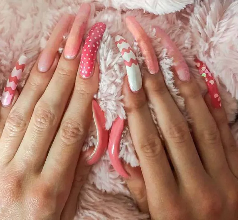 CURA PU&Scaron;TA NOKTE VEĆ 3 GODINE: Potpuno je nesposobna s njima, a ako slomi nokat uhvati je histerija