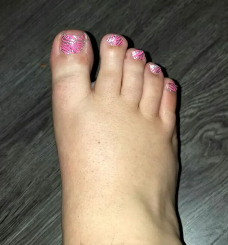 Kladio se da mu ne može obrijati noge dok spava bez da ga probudi... probudio se s pedikurom