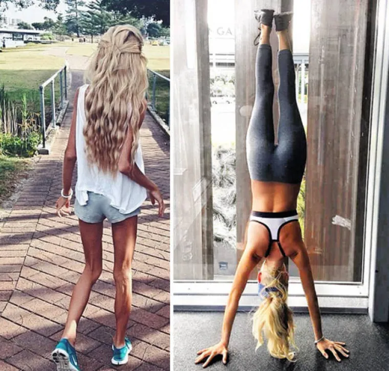 SABLASNE POSLJEDICE ANOREKSIJE: Objavili fotografije snimljene prije i nakon oporavka, rezultati su stvarno impresivni