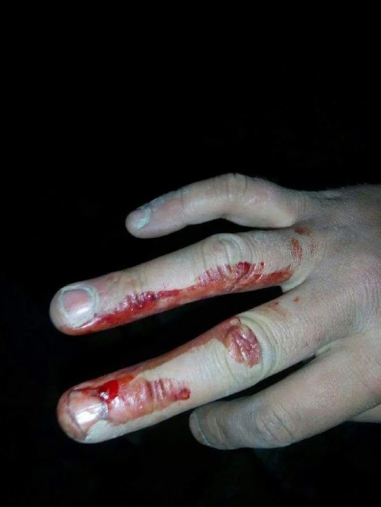 Incijativa Dobrodo&scaron;li! i Are You Syrious? priložili fotografije kao dokaz policijskog nasilja nad izbjeglicama