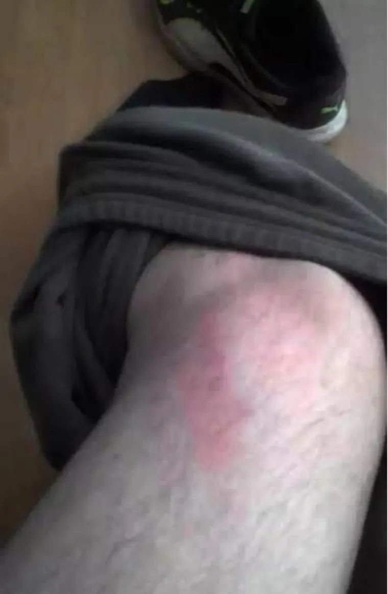 Incijativa Dobrodo&scaron;li! i Are You Syrious? priložili fotografije kao dokaz policijskog nasilja nad izbjeglicama