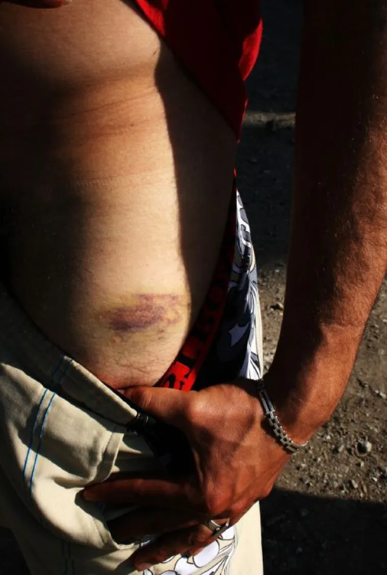 Incijativa Dobrodo&scaron;li! i Are You Syrious? priložili fotografije kao dokaz policijskog nasilja nad izbjeglicama