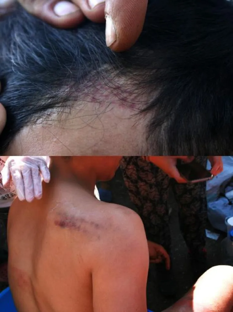 Incijativa Dobrodo&scaron;li! i Are You Syrious? priložili fotografije kao dokaz policijskog nasilja nad izbjeglicama