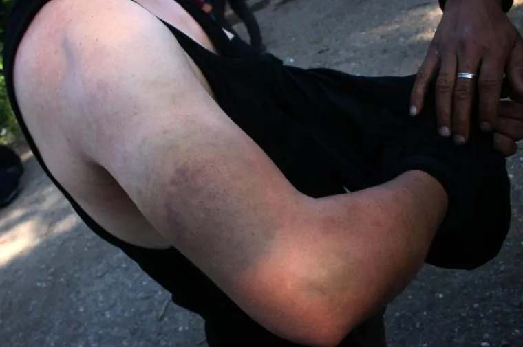 Incijativa Dobrodo&scaron;li! i Are You Syrious? priložili fotografije kao dokaz policijskog nasilja nad izbjeglicama