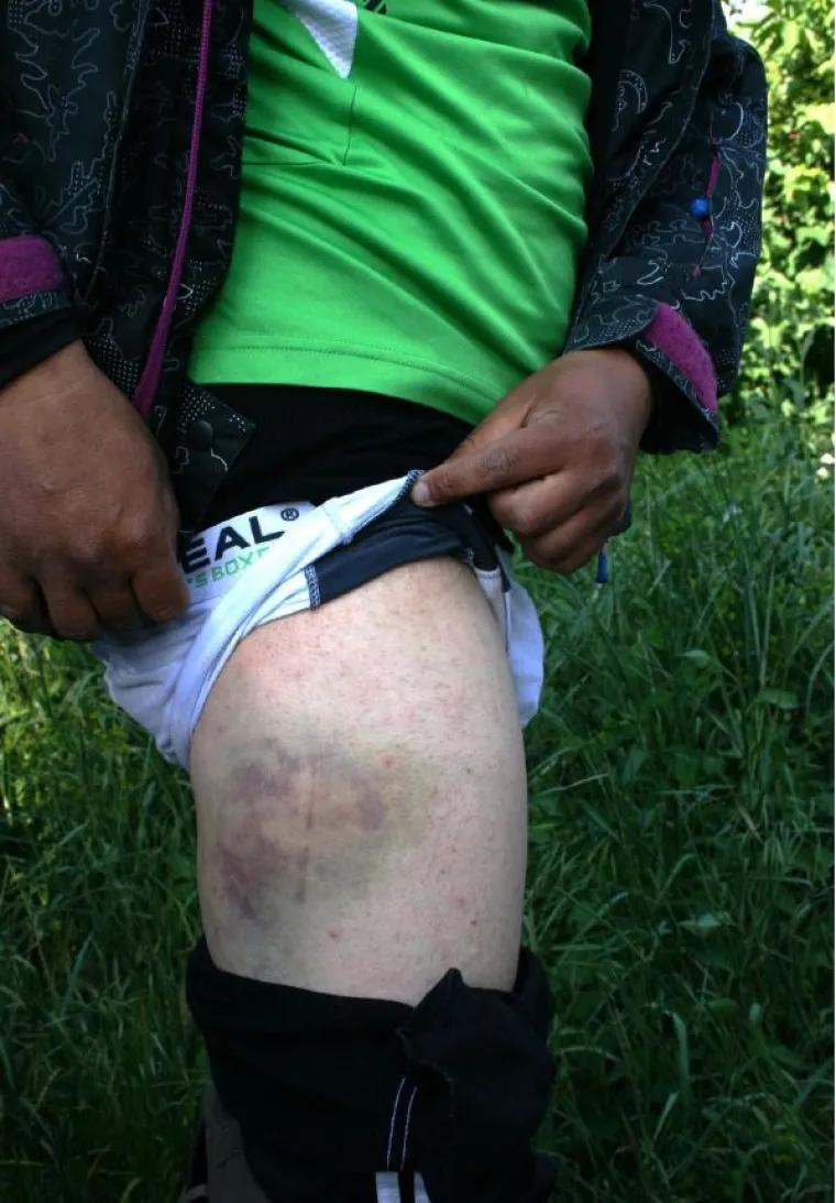 Incijativa Dobrodo&scaron;li! i Are You Syrious? priložili fotografije kao dokaz policijskog nasilja nad izbjeglicama