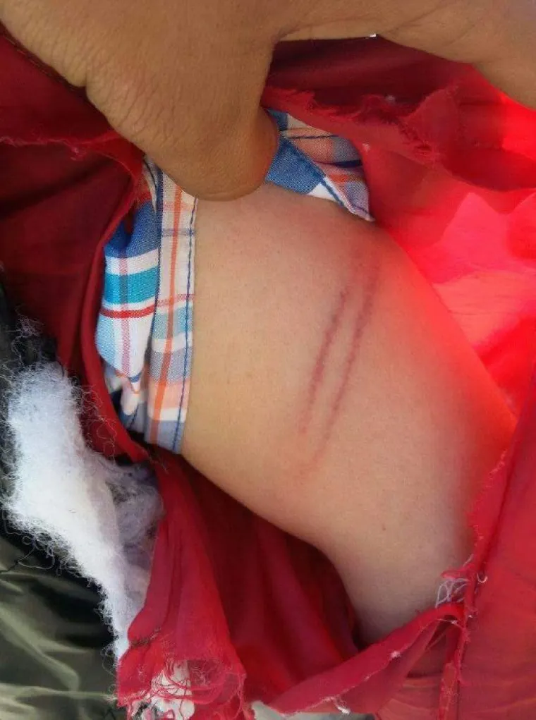 Incijativa Dobrodo&scaron;li! i Are You Syrious? priložili fotografije kao dokaz policijskog nasilja nad izbjeglicama