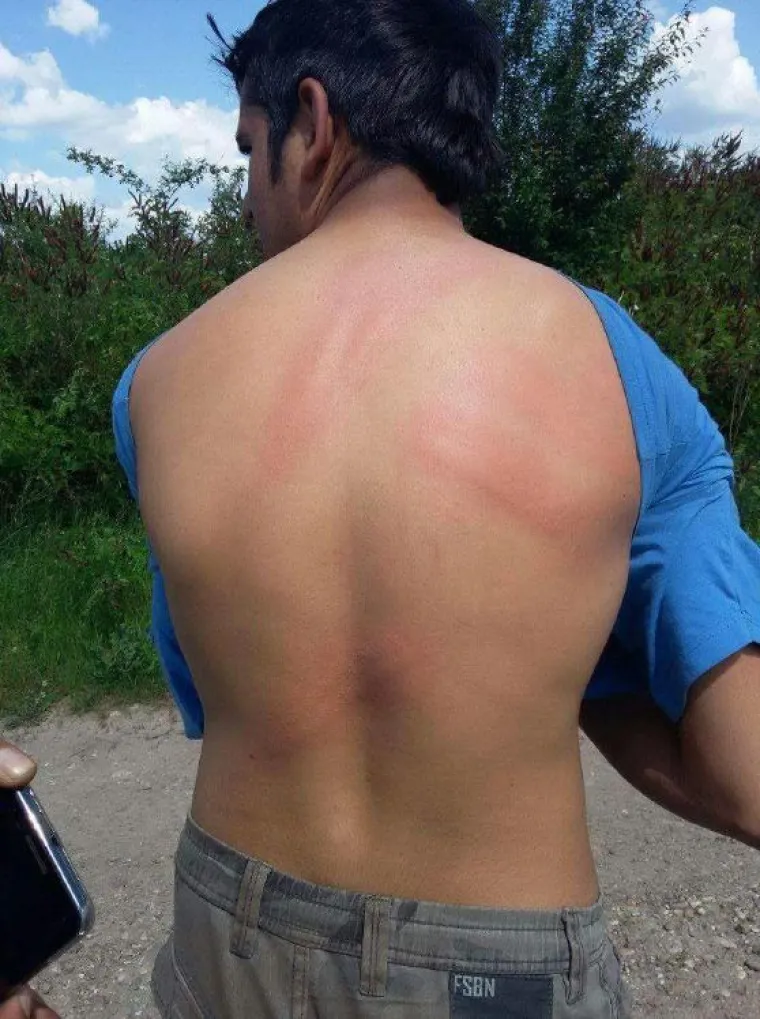 Incijativa Dobrodo&scaron;li! i Are You Syrious? priložili fotografije kao dokaz policijskog nasilja nad izbjeglicama