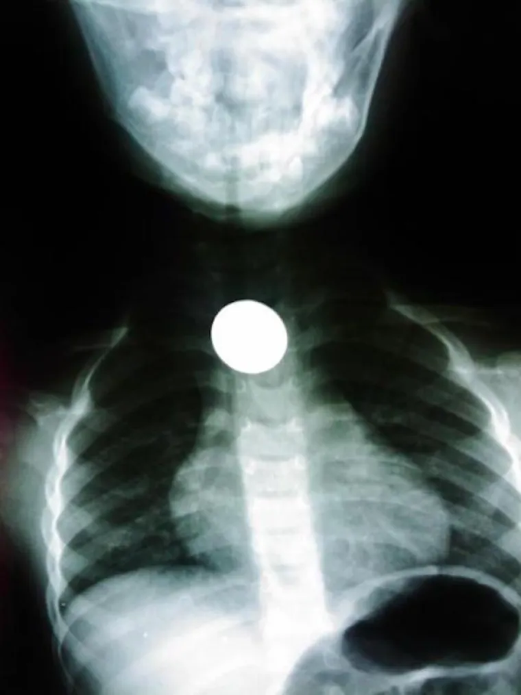 LJUDI SU ČAROBNO SPREMI&Scaron;TE, U NJIH STANE BA&Scaron; SVE: Nevjerojatne snimke pokazuju &scaron;to su sve uspjeli ugurati u sebe