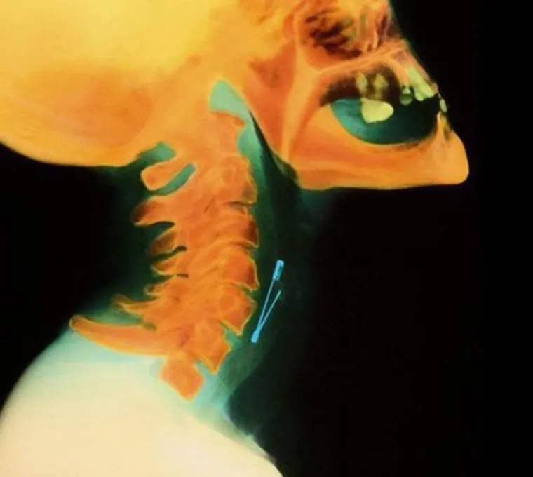 LJUDI SU ČAROBNO SPREMI&Scaron;TE, U NJIH STANE BA&Scaron; SVE: Nevjerojatne snimke pokazuju &scaron;to su sve uspjeli ugurati u sebe