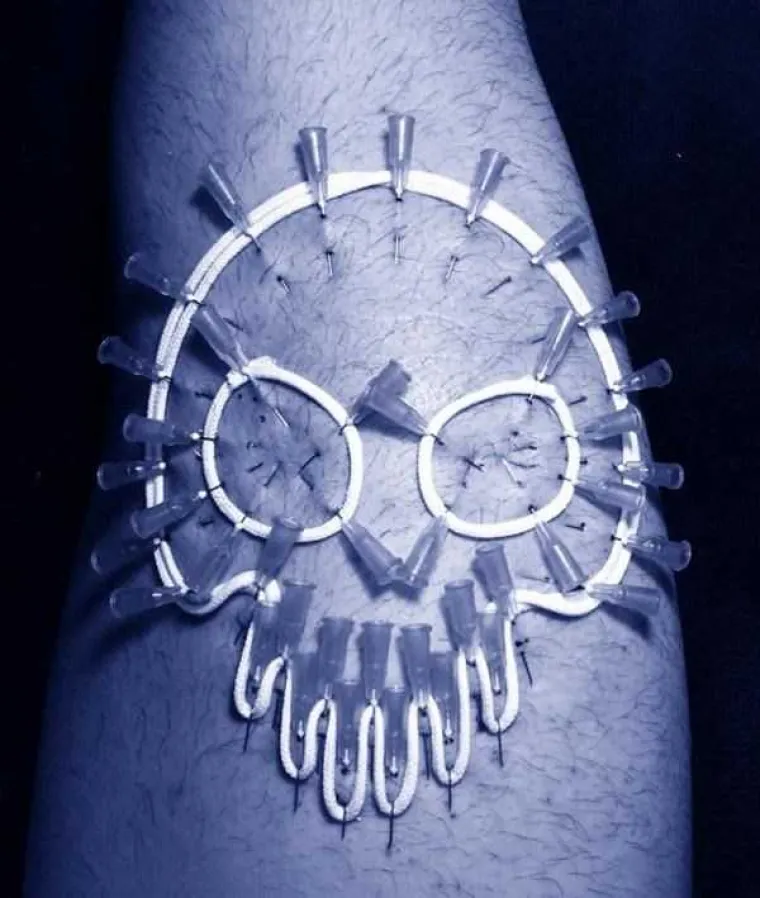 OPREZ, NIJE ZA OSJETLJIVE! Od ovog modnog trenda imat ćete noćne more - oni koriste medicinske igle kao nakit!