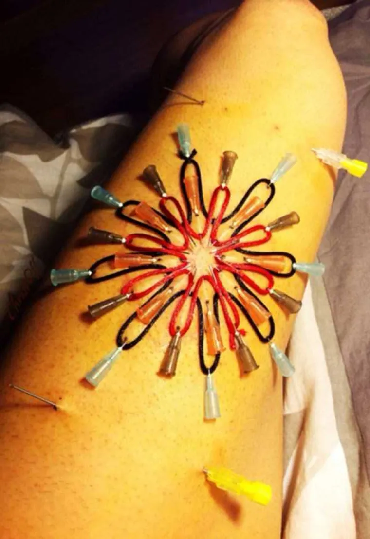 OPREZ, NIJE ZA OSJETLJIVE! Od ovog modnog trenda imat ćete noćne more - oni koriste medicinske igle kao nakit!