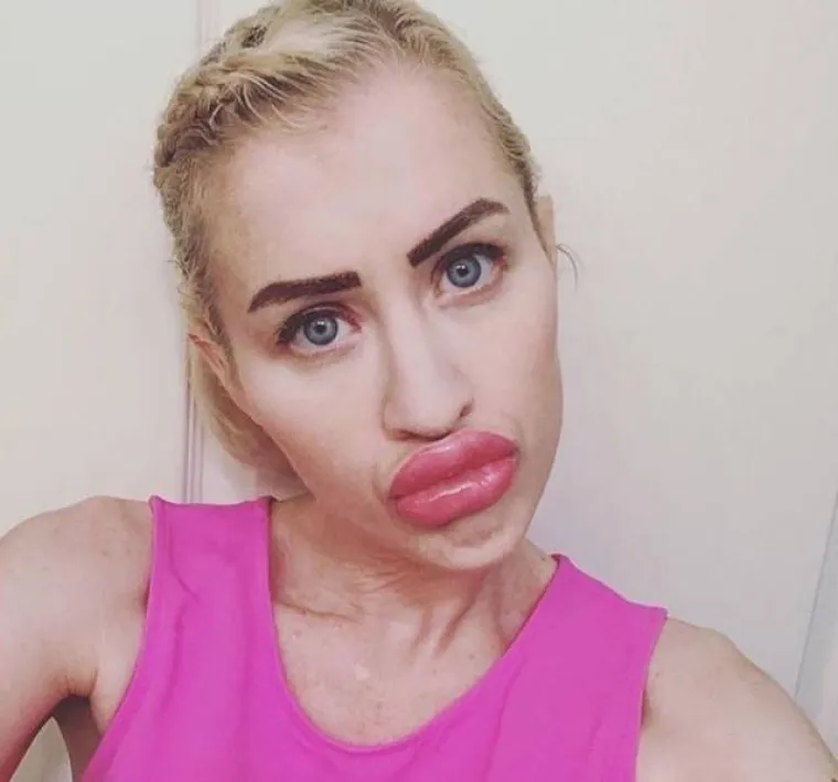 OPSJEDNUTE SU SILIKONIMA: Čini li se i vama da su možda pretjerale s uštrcavanjem plastike u svoje tijelo?