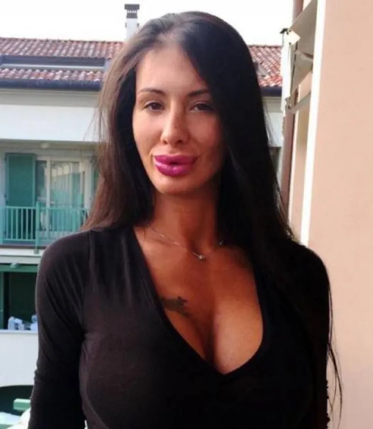 OPSJEDNUTE SU SILIKONIMA: Čini li se i vama da su možda pretjerale s uštrcavanjem plastike u svoje tijelo?