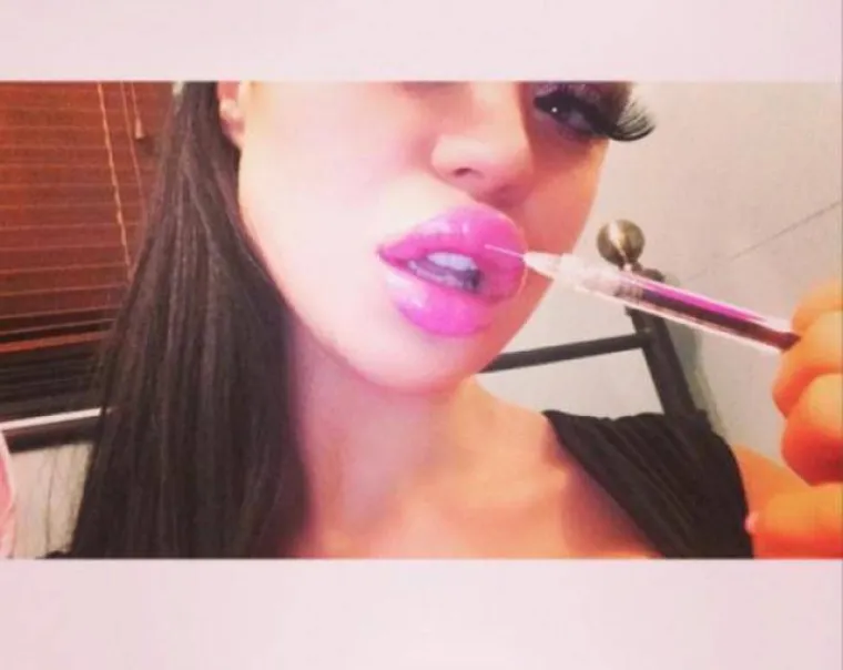 OPSJEDNUTE SU SILIKONIMA: Čini li se i vama da su možda pretjerale s uštrcavanjem plastike u svoje tijelo?