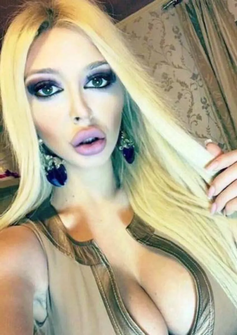 OPSJEDNUTE SU SILIKONIMA: Čini li se i vama da su možda pretjerale s u&scaron;trcavanjem plastike u svoje tijelo?