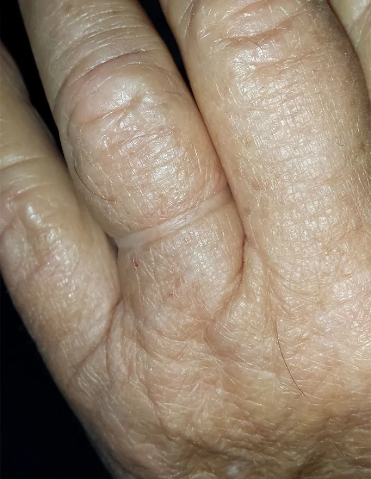 Nakon 50 godina braka...