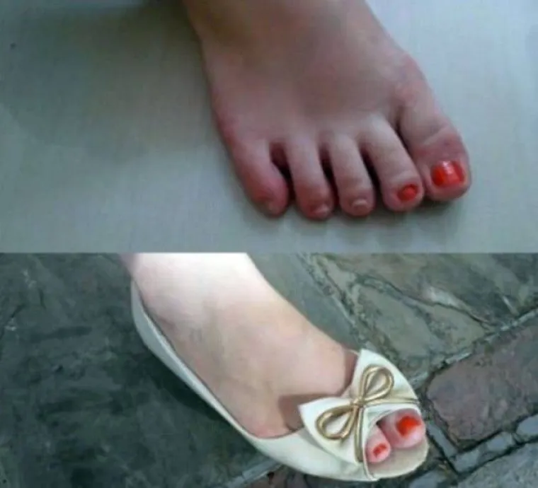 LIJENOST JE NAJBOLJI LJUDSKI IZUM: Pogledajte ova idealna rje&scaron;enja, možda vam dobro dođu na nesnosnoj vrućini