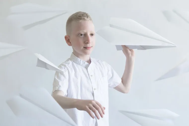 PORCULANSKA LJEPOTA: Umjetnica fotografirala osobe s albinizmom, pogledajte za&scaron;to je njezin rad obi&scaron;ao cijeli svijet