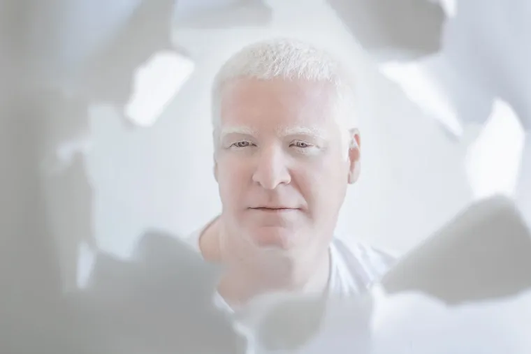 PORCULANSKA LJEPOTA: Umjetnica fotografirala osobe s albinizmom, pogledajte za&scaron;to je njezin rad obi&scaron;ao cijeli svijet