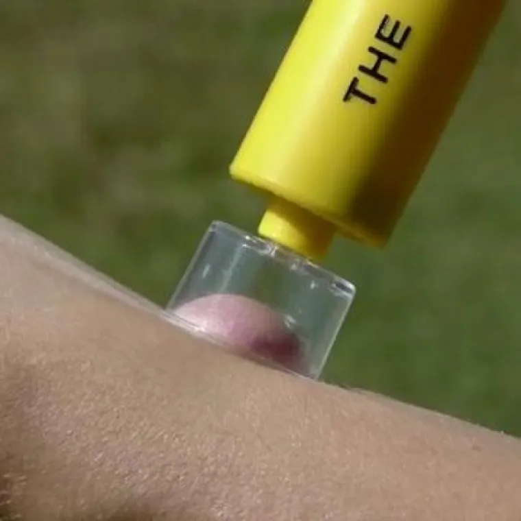 Ako vas je ugrizla zmija, više nije nužno ići hitno u bolnicu. Ovaj uređaj može vam spasiti život jer isisava otrov. Koristan je i kod uboda pčele, ose, komarca ili pauka.