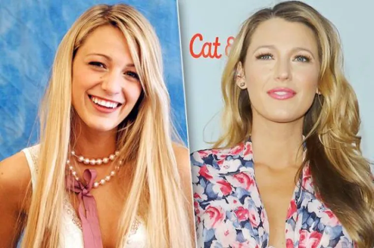 JE LI IM TO STVARNO TREBALO? Zvijezde povećale usne, pogledajte kako su izgledale prije, a kako nakon operacije