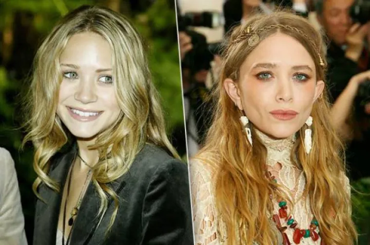 JE LI IM TO STVARNO TREBALO? Zvijezde povećale usne, pogledajte kako su izgledale prije, a kako nakon operacije