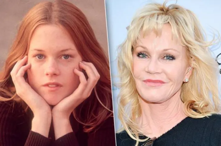 JE LI IM TO STVARNO TREBALO? Zvijezde povećale usne, pogledajte kako su izgledale prije, a kako nakon operacije