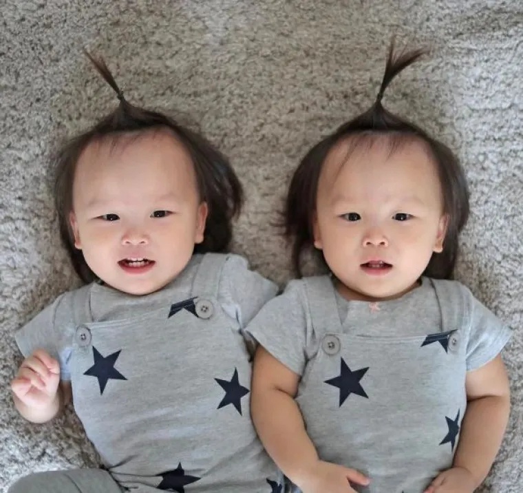 Prekrasne blizanke osvojile su Instagram - a ni mi im ne možemo odoljeti