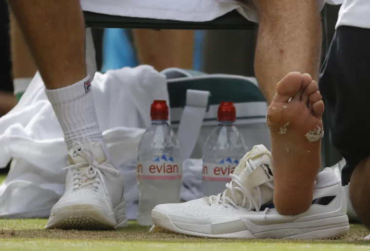 Fotografije otkrivaju razlog lo&scaron;e Čilićeve igre? Pogledajte o čemu se radi